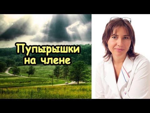 Найбільш ефективним способом профілактики інфекційної висипу є виключення випадкових інтимних зв'язків