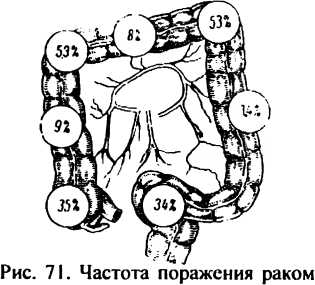 71