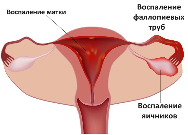 Може бути кілька причин хвороби: