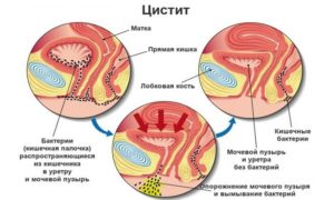 Коли ми мочімся нормально, то мало хто звертає на це увагу