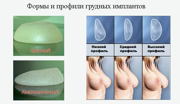 Якщо мова йде тільки про підтяжки грудей, то вона складе близько 40000 рублів