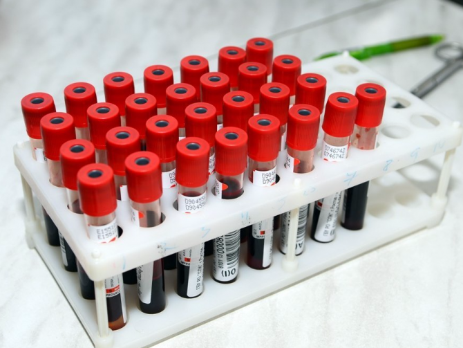 Автор: Михайло Хецуріані, медичний редактор   Іноді для оцінки стану здоров'я пацієнта необхідно проведення аналізу на газовий склад артеріальної крові