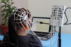 Мозок людини складається з безлічі нейронів, завдання кожного з них генерувати нервові імпульси і передавати їх сусіднім клітинам