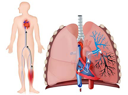 Клініка ТЕЛА визначається її формою