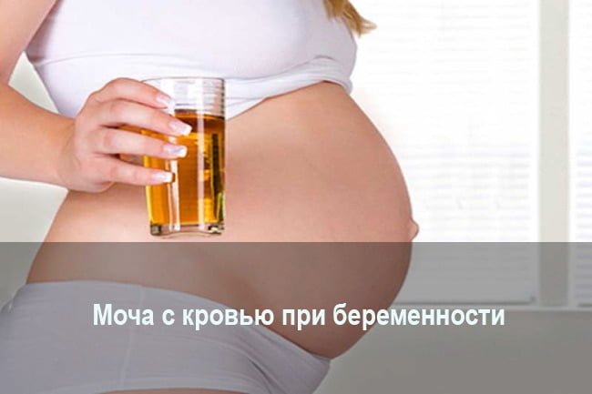 У період вагітності жінці доводиться здавати безліч аналізів