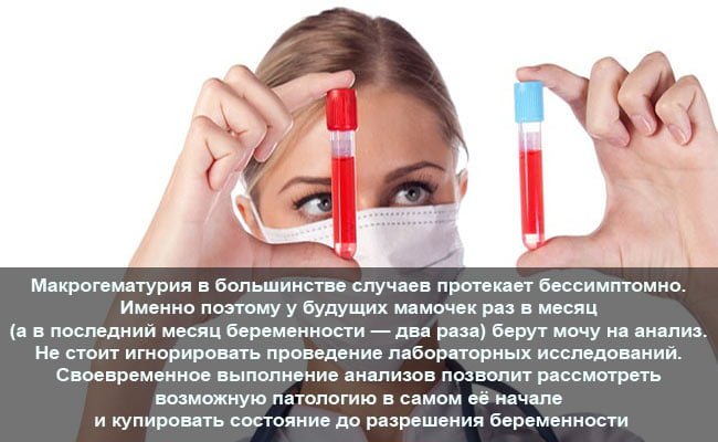 Ознаки, за якими визначають гематурію