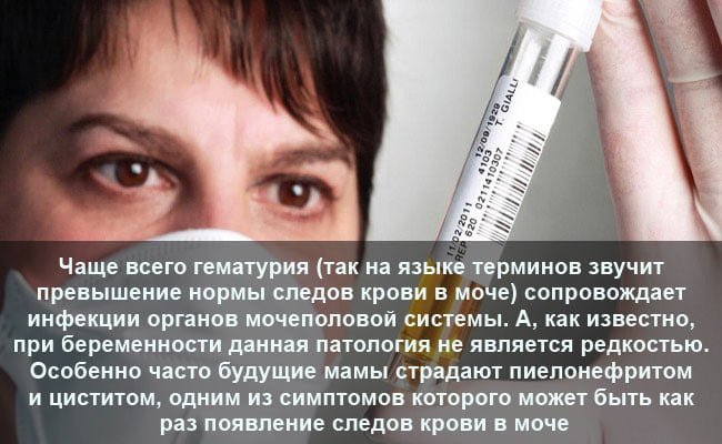 Захворювання нирок і сечовидільної системи