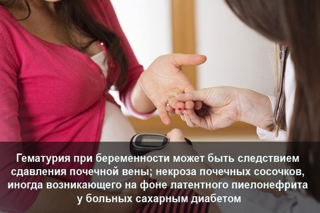 інші хвороби