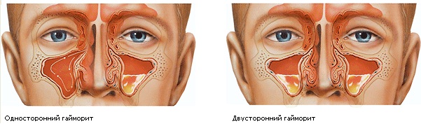 Для діагностики та лікування наш доктор-отоларинголог використовує унікальне новітнє обладнання - ЛОР-стійку, завдяки якій всі огляди і процедури проходять для пацієнта практично без дискомфорту