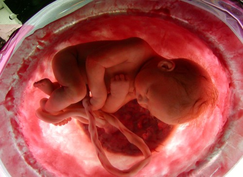 На підставі отриманих даних приймається рішення про використання спеціальної медичної техніки для підтримки життєдіяльності малюка протягом певного терміну