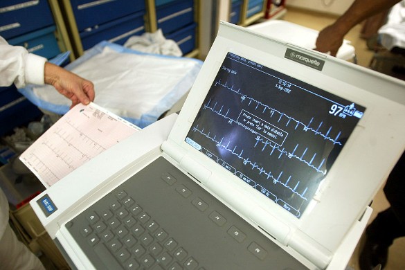 На кардіологічному конгресі Heart Failure Congress 2014 року, що проходив в Афінах, повідомлялося, що японські медики спостерігали за 111 хворими, госпіталізованими з ускладненнями серцево-судинних захворювань, протягом 180 днів після виписки