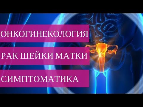 За гістологічної формі найпоширенішими формами раку шийки матки є плоскоклітинний рак і аденокарцинома