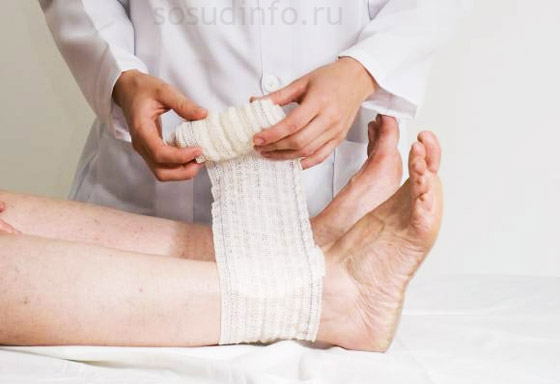 На всіх стадіях лікування обов'язково повинна виконуватися еластична компресія