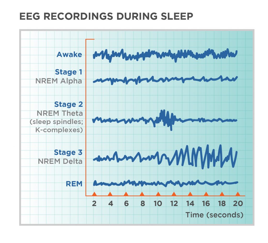 обзор   Обычно спящие проходят четыре стадии: 1, 2, 3 и REM (быстрое движение глаз) сна