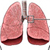 Симптоми і ознаки астми   - Перебіг нападу може бути різним у різних хворих