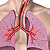Класифікація і діагностика бронхіальної астми   - Діагностика захворювання здійснюється поступово: в першу чергу визначаються ознаки, виявлені самим пацієнтом, після чого здійснюється обстеження пацієнта