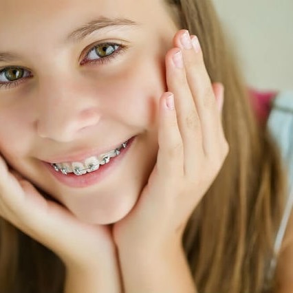 Дітям брекет-систему можна поставити приблизно з 11-13 років (точний вік установки брекетів назве фахівець-ортодонт), коли всі корінні зуби вже прорізалися, але ще досить податливі для лікування
