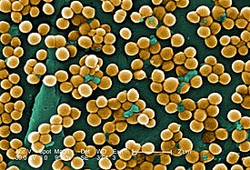 золотистий стафілокок   Колоризувати фотографія бактерії в електронному мікроскопі   наукова класифікація   Міжнародне наукове назву