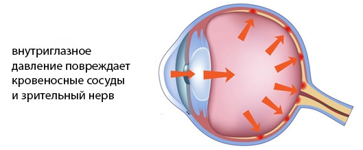Зберігає сферичну форму очного яблука;   Створює сприятливі умови для збереження анатомічної будови ока і його структур;   Підтримує на нормальному рівні кровообіг в мікроциркуляторному руслі і обмінні процеси в тканинах очного яблука