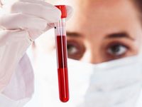 Дізнайтеся про те, за яких симптомах необхідно здати аналіз крові на   кальцитонін   і що показують результати