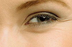 З усіх типів мімічні зморшки на шкірі обличчя з'являються, як правило, першими в самому ранньому віці